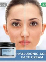 کرم مرطوب کننده فشرده هیالورونیک اسید کزارکس- cosrx Hyaluronic Acid Intensive Cream - تصویر 3