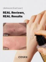 سرم ترمیم کننده ۹۶٪ موکوس حلزون COSRX -Advanced Snail 96 Mucin Power Essence 100ml - تصویر 5