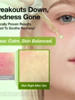 سرم تسکین دهنده قرمزی هیالورون اسید آزلائیک  آنوا -Azelaic Acid 10 Hyaluron Redness Soothing Serum - تصویر 3