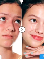 -سرم  هیالتوئین ایکوئل بری-   eqqualberry global Hyaltoin Flooding Serum - تصویر 3