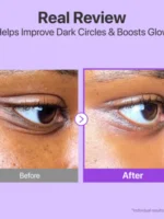 دور چشم نامبوزین -No.9 NAD+ Retinol Volumetox Eye Cream - تصویر 4