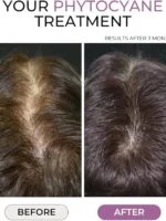 قرص فیتوسیان  ساخت فرانسه -PHYTO PHYTOCYANE Anti-Hair Thinning Dietary Supplement - تصویر 4