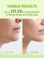 ماسک کاکتوس لیفت غبغب و ضد پف کلاژن و کافئین دکتر ملاکسین ورقه ای Dr.Melaxin CACTOX V-Lifting Mewing Band - تصویر 2