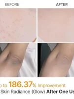 اسپری لایه بردار بدن دکتر ملکسین پیل شات با اسید کوجیک و زردچوبه Dr.Melaxin Peel Shot Kojic Acid Turmeric Body Exfoliator Spray - تصویر 2