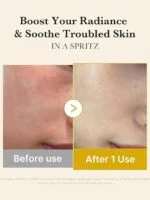 میست ژلی مدیکوب با اسید کوجیک و زردچوبه medicube Jelly Mist Serum with Kojic Acid Turmeric - تصویر 2