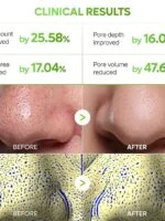 پک ماسک بینی 3 مرحله کاکتوس دکتر ملاکسین DR.MELAXIN CACTOX 3-Step Nose Mask Pack - تصویر 3